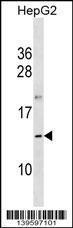 Anti-OOSP1 Rabbit Polyclonal Antibody (HRP (Horseradish Peroxidase))