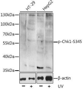 Western blot analysis of extracts of various cell lines, using Anti-Chk1 (phospho Ser345) Antibody (A11056). The secondary antibody was Goat Anti-Rabbit IgG HandL Antibody (HRP) at 1:10,000 dilution. Lysates/proteins were present at 25 µg per lane. The blocking buffer used was 3% BSA