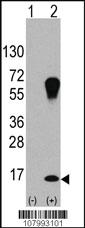 Anti-LC3 (APG8A) Rabbit Polyclonal Antibody