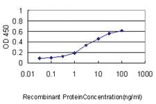 Anti-S100 A1 Mouse Monoclonal Antibody [clone: 1D5]