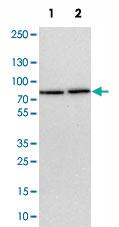 Anti-TBC1D15 Rabbit Polyclonal Antibody