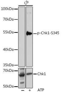 Western blot analysis of extracts of C6 cells, using Anti-Chk1 (phospho Ser345) Antibody (A11056) at 1:1,000 dilution or Chk1 antibody (A7653). C6 cells were treated by ATP(5 mM) at 30°C for 1 hour. The secondary antibody was Goat Anti-Rabbit IgG HandL Antibody (HRP) at 1:10,000 dilution