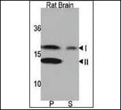 Anti-LC3 (APG8A) Rabbit Polyclonal Antibody