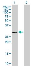 Anti-ATP6V1E2 Mouse Polyclonal Antibody