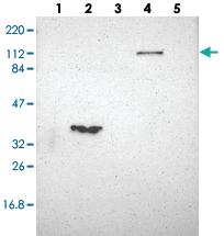 Anti-FAM65A Rabbit Polyclonal Antibody