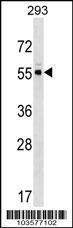 Anti-PACSIN3 Rabbit Polyclonal Antibody (Biotin)