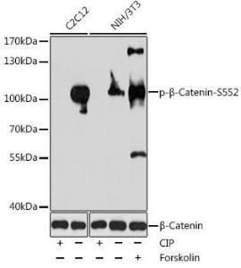 Western blot analysis of extracts of various cell lines, using Anti-beta Catenin (phospho Ser552) Antibody (A11057) at 1:1,000 dilution. C2C12 cell