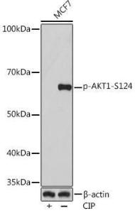 Western blot analysis of extracts of MCF7 cells, using Anti-AKT1 (phospho Ser124) Antibody [ARC1526] (A308682) at 1:1,000 dilution. MCF7 cells were treated by CIP(20uL/400ul) at 37°C for 1 hour. The secondary antibody was Goat Anti-Rabbit IgG H&L Antibody (HRP) at 1:10,000 dilution.