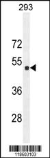 Anti-Sestrin-2 Rabbit Polyclonal Antibody