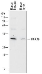 Anti-LRRC3B Mouse Monoclonal Antibody [clone: 758315]