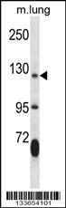 Anti-JAK2 Rabbit Polyclonal Antibody (FITC (Fluorescein Isothiocyanate))