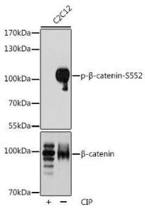 Western blot analysis of extracts of C2C12 cells, using Anti-beta Catenin (phospho Ser552) Antibody (A11057) at 1:1,000 dilution or beta-Catenin antibody (A11932). C2C12 cell