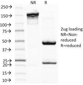 Anti-MiTF Mouse Monoclonal Antibody [clone: D5]