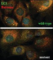 Anti-LC3 (APG8A) Rabbit Polyclonal Antibody