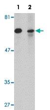 Anti-SLC37A2 Rabbit Polyclonal Antibody