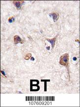 Anti-LC3 (APG8A) Rabbit Polyclonal Antibody