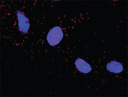 Anti-PKM2 + ARAF Antibody Pair