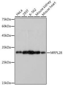 Western blot analysis of extracts of various cell lines, using Anti-MRPL28 Antibody [ARC2507] (A307620) at 1:1,000 dilution