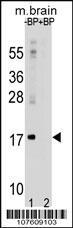 Anti-LC3 (APG8A) Rabbit Polyclonal Antibody