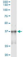 Anti-NKX2-5 Mouse Monoclonal Antibody [clone: 4B11]