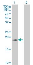 Anti-SUMO3 Mouse Monoclonal Antibody [clone: 4G11]