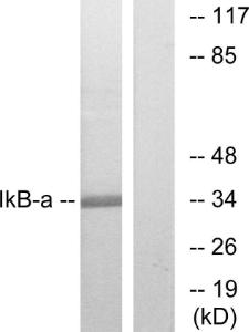 Western blot analysis of lysates from MCF7 cells, treated with TNF-α using Anti-IkappaB-alpha Antibody. The right hand lane represents a negative control, where the Antibody is blocked by the immunising peptide