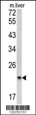 Anti-SPCS3 Rabbit Polyclonal Antibody