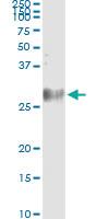 Anti-MREG Antibody Pair