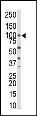 Anti-PKN3 Rabbit Polyclonal Antibody (AP (Alkaline Phosphatase))