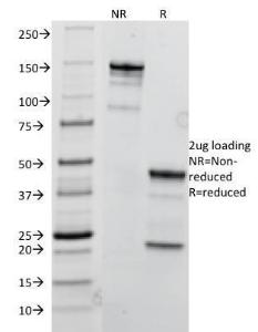 SDS-PAGE analysis of Anti-TRIM29 Antibody [TRIM29/1041] under non-reduced and reduced conditions; showing intact IgG and intact heavy and light chains, respectively. SDS-PAGE analysis confirms the integrity and purity of the antibody.