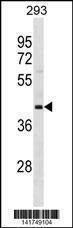 Anti-OPCML Rabbit Polyclonal Antibody (Biotin)