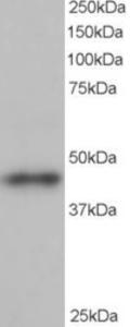 EB06350 staining (1µg/ml) of human heart lysate (RIPA buffer, 35µg total protein per lane). Primary incubated for 1 hour. Detected by western blot using chemiluminescence.