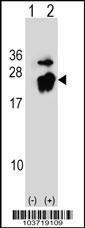 Anti-Prostatic Binding Protein Rabbit Polyclonal Antibody (AP (Alkaline Phosphatase))