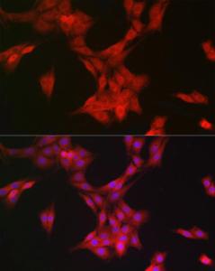 Immunofluorescence analysis of PC-12 cells using Anti-MRPL28 Antibody [ARC2507] (A307620) at a dilution of 1:100 (40X lens). DAPI was used to stain the cell nuclei (blue)