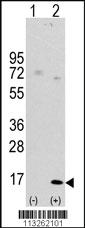 Anti-ODF3 Rabbit Polyclonal Antibody