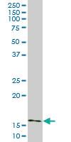 Anti-AGR2 Mouse Monoclonal Antibody [clone: 1E5]