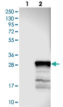 Anti-TEX33 Rabbit Polyclonal Antibody