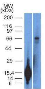 Western blot analysis of TRIM29 recombinant protein fragment and A431 cell lysate using Anti-TRIM29 Antibody [TRIM29/1042]