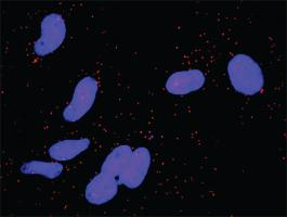 Anti-CCND3 + AREG Antibody Pair