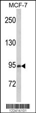 Anti-PREX1 Rabbit Polyclonal Antibody