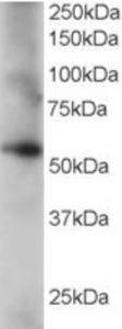 EB06357 staining (0.2µg/ml) of human lung lysate (RIPA buffer, 35µg total protein per lane).  Primary incubated for 1 hour.  Detected by western blot using chemiluminescence.