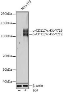 Western blot analysis of extracts of NIH/3T3 cells, using Anti-c-Kit (phospho Tyr719) Antibody (A11064) at 1:500 dilution