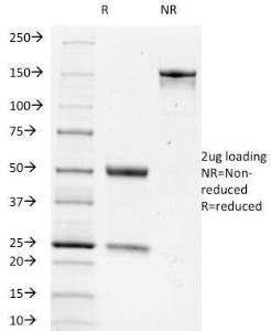 SDS-PAGE analysis of Anti-TRIM29 Antibody [TRIM29/1042] under non-reduced and reduced conditions; showing intact IgG and intact heavy and light chains, respectively. SDS-PAGE analysis confirms the integrity and purity of the antibody.