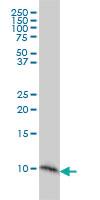 Anti-S100 A2 Mouse Monoclonal Antibody [clone: 3H8]