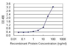 Anti-CARD8 Polyclonal Antibody Pair