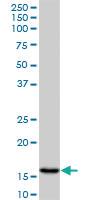 Anti-AGR2 Mouse Monoclonal Antibody [clone: 1E5]