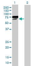 Anti-CHEK2 Mouse Polyclonal Antibody