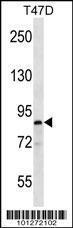 Anti-MARK1 Rabbit Polyclonal Antibody (Biotin)