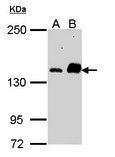 Anti-CARD11 Rabbit polyclonal antibody