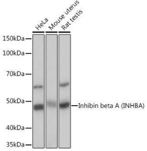 Western blot analysis of extracts of various cell lines, using Anti-Inhibin beta A Antibody [ARC1177] (A307621) at 1:1,000 dilution